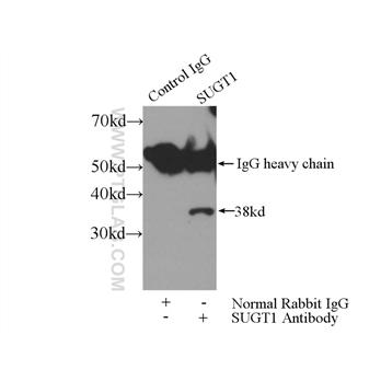 SUGT1 Rabbit Polyclonal Antibody (11675-1-AP)