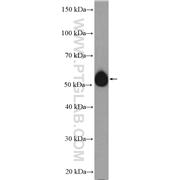 AP4M1 Rabbit Polyclonal Antibody (11653-1-AP)