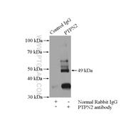 PTPN2 Rabbit Polyclonal Antibody (11214-1-AP)