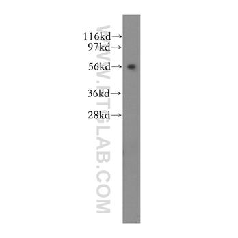 KLC3 Rabbit Polyclonal Antibody (11645-1-AP)