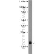RTN2 Rabbit Polyclonal Antibody (11168-1-AP)