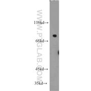 NCKIPSD Rabbit Polyclonal Antibody (11367-1-AP)