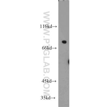 NCKIPSD Rabbit Polyclonal Antibody (11367-1-AP)