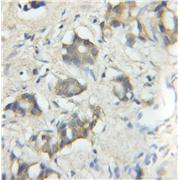 TRIM5 Rabbit Polyclonal Antibody (11476-1-AP)