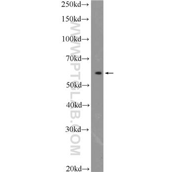 PSMC1 Rabbit Polyclonal Antibody (11196-1-AP)