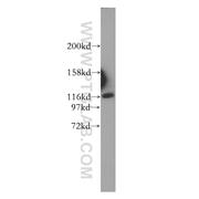 IPO4 Rabbit Polyclonal Antibody (11679-1-AP)