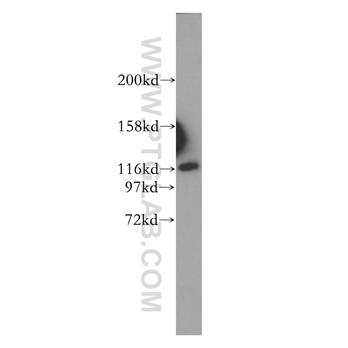 IPO4 Rabbit Polyclonal Antibody (11679-1-AP)