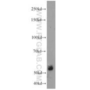 ECM1 Rabbit Polyclonal Antibody (11521-1-AP)