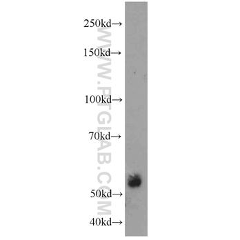 ECM1 Rabbit Polyclonal Antibody (11521-1-AP)