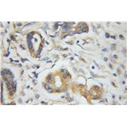 PLEK2 Rabbit Polyclonal Antibody (11685-1-AP)