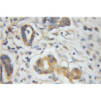 PLEK2 Rabbit Polyclonal Antibody (11685-1-AP)