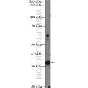 FTSJ1 Rabbit Polyclonal Antibody (11620-1-AP)