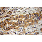 BIN3 Rabbit Polyclonal Antibody (11215-1-AP)