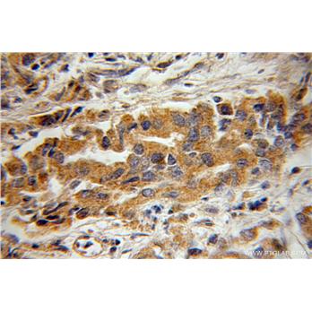 BIN3 Rabbit Polyclonal Antibody (11215-1-AP)