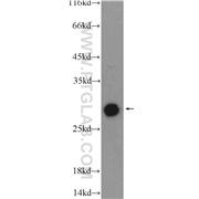 DNAJB6 Rabbit Polyclonal Antibody (11707-1-AP)
