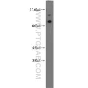 MAGED1 Rabbit Polyclonal Antibody (11539-1-AP)