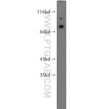 MAGED1 Rabbit Polyclonal Antibody (11539-1-AP)