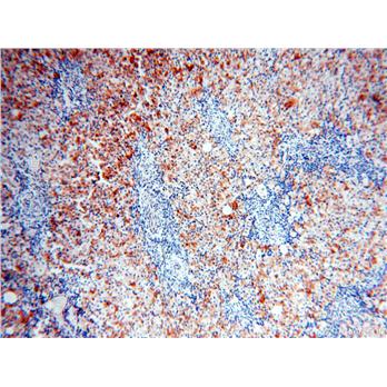 XPO6 Rabbit Polyclonal Antibody (11408-1-AP)