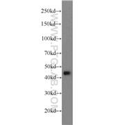 ADRM1 Rabbit Polyclonal Antibody (11468-1-AP)