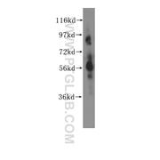 CHRNA6 Rabbit Polyclonal Antibody (11388-1-AP)