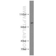 BBS2 Rabbit Polyclonal Antibody (11188-2-AP)