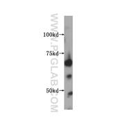 IGF2BP2 Rabbit Polyclonal Antibody (11601-1-AP)