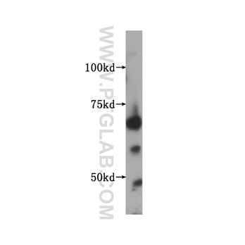 IGF2BP2 Rabbit Polyclonal Antibody (11601-1-AP)