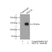 SKIV2L Rabbit Polyclonal Antibody (11462-1-AP)