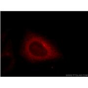 EHD4 Rabbit Polyclonal Antibody (11382-2-AP)