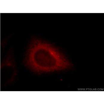 EHD4 Rabbit Polyclonal Antibody (11382-2-AP)