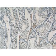 COX6B2 Rabbit Polyclonal Antibody (11437-1-AP)