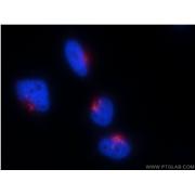 GOLGA2 Rabbit Polyclonal Antibody (11308-1-AP)