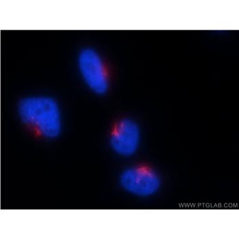 GOLGA2 Rabbit Polyclonal Antibody (11308-1-AP)
