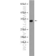 HAX1 Rabbit Polyclonal Antibody (11266-1-AP)