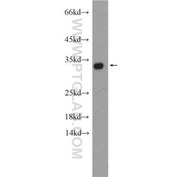HAX1 Rabbit Polyclonal Antibody (11266-1-AP)