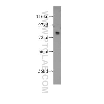MED17 Rabbit Polyclonal Antibody (11505-1-AP)
