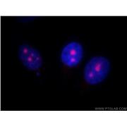 UTP14A Rabbit Polyclonal Antibody (11474-1-AP)