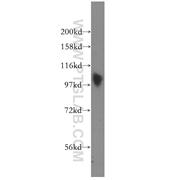 SP100 Rabbit Polyclonal Antibody (11377-1-AP)