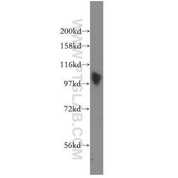SP100 Rabbit Polyclonal Antibody (11377-1-AP)