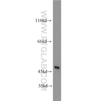 MARCKSL1 Rabbit Polyclonal Antibody (11422-1-AP)
