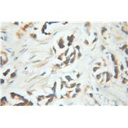 PNKD Rabbit Polyclonal Antibody (11584-1-AP)