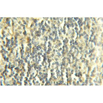 COX7B Rabbit Polyclonal Antibody (11417-2-AP)