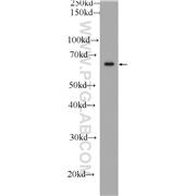 FRS2 Rabbit Polyclonal Antibody (11503-1-AP)