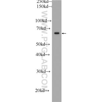 FRS2 Rabbit Polyclonal Antibody (11503-1-AP)