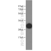 MYOZ2 Rabbit Polyclonal Antibody (11450-1-AP)