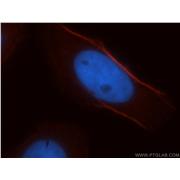 CNN3 Rabbit Polyclonal Antibody (11509-1-AP)