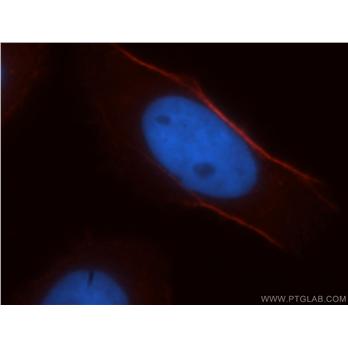 CNN3 Rabbit Polyclonal Antibody (11509-1-AP)