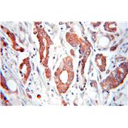 FBXO9 Rabbit Polyclonal Antibody (11161-1-AP)