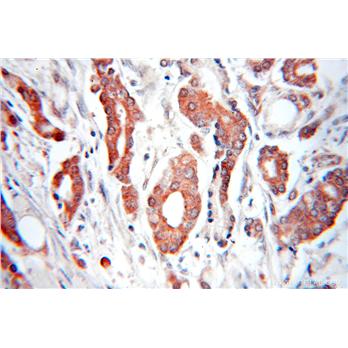 FBXO9 Rabbit Polyclonal Antibody (11161-1-AP)