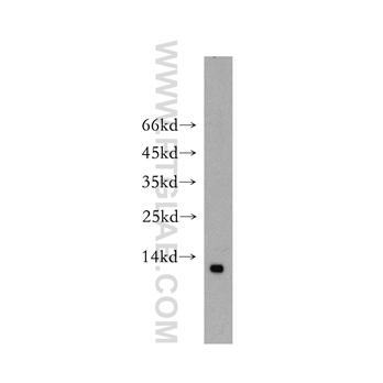 SUMO2 Rabbit Polyclonal Antibody (11251-1-AP)